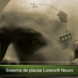 SISTEMA DE PLACAS Lorenz® Neuro 1.5 MM